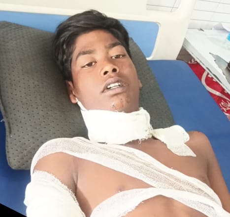 आवागमन मार्ग के बगल में लगे ब्लेड की तारों में फंसकर चार  बच्चे घायल, तीन की हालत नाजुक